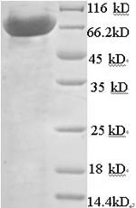 Recombinant Human N-acetylmuramoyl-L-alanine amidase (PGLYRP2) – Figure 1 of 1