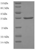 Recombinant Human Alpha-ketoglutarate-dependent dioxygenase alkB homolog 3 (ALKBH3) – Figure 1 of 1