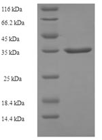 Recombinant Human Alpha-ketoglutarate-dependent dioxygenase alkB homolog 3 (ALKBH3) – Figure 1 of 1