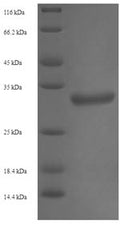 Recombinant Human Trimethylguanosine synthase (TGS1), partial – Figure 1 of 1