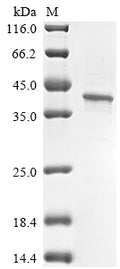 (Tris-Glycine gel) Discontinuous SDS-PAGE (reduced) with 5% enrichment gel and 15% separation gel.