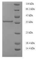 Recombinant Human Phosphatidylinositol-glycan biosynthesis class X protein (PIGX), partial – Figure 1 of 1