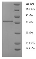 Recombinant Human Phosphatidylinositol-glycan biosynthesis class X protein (PIGX), partial – Figure 1 of 1