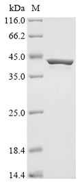 (Tris-Glycine gel) Discontinuous SDS-PAGE (reduced) with 5% enrichment gel and 15% separation gel.
