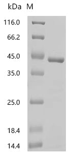 (Tris-Glycine gel) Discontinuous SDS-PAGE (reduced) with 5% enrichment gel and 15% separation gel.