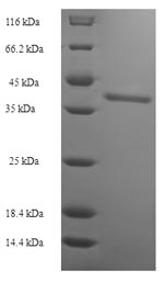 Recombinant Human Butyrophilin subfamily 2 member A2 (BTN2A2), partial – Figure 1 of 1
