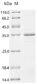 (Tris-Glycine gel) Discontinuous SDS-PAGE (reduced) with 5% enrichment gel and 15% separation gel.