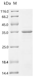 (Tris-Glycine gel) Discontinuous SDS-PAGE (reduced) with 5% enrichment gel and 15% separation gel.