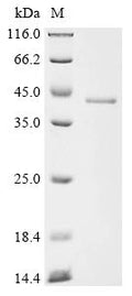 (Tris-Glycine gel) Discontinuous SDS-PAGE (reduced) with 5% enrichment gel and 15% separation gel.
