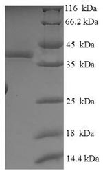 Recombinant Human SOSS complex subunit B2 (OBFC2A) – Figure 1 of 1