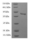 Recombinant Human Endothelial cell-selective adhesion molecule (ESAM), partial – Figure 1 of 1