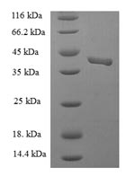 Recombinant Human Endothelial cell-selective adhesion molecule (ESAM), partial – Figure 1 of 1