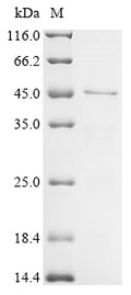 (Tris-Glycine gel) Discontinuous SDS-PAGE (reduced) with 5% enrichment gel and 15% separation gel.