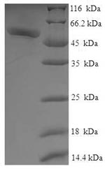 Recombinant Human Galactose mutarotase (GALM) – Figure 1 of 1