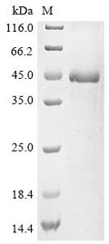 (Tris-Glycine gel) Discontinuous SDS-PAGE (reduced) with 5% enrichment gel and 15% separation gel.