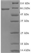 Recombinant Human Probable imidazolonepropionase (AMDHD1) – Figure 1 of 1