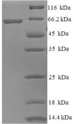 Recombinant Human Probable imidazolonepropionase (AMDHD1) – Figure 1 of 1