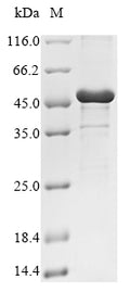 (Tris-Glycine gel) Discontinuous SDS-PAGE (reduced) with 5% enrichment gel and 15% separation gel.