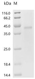 (Tris-Glycine gel) Discontinuous SDS-PAGE (reduced) with 5% enrichment gel and 15% separation gel.