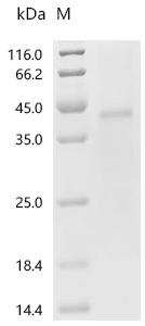(Tris-Glycine gel) Discontinuous SDS-PAGE (reduced) with 5% enrichment gel and 15% separation gel.