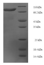 Recombinant Human Kelch-like protein 36 (KLHL36) – Figure 1 of 1