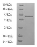 Recombinant Human Mitochondrial intermembrane space import and assembly protein 40 (CHCHD4) – Figure 1 of 1