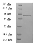 Recombinant Human Mitochondrial intermembrane space import and assembly protein 40 (CHCHD4) – Figure 1 of 1