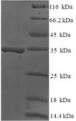 Recombinant Human DAN domain family member 5 (DAND5) – Figure 1 of 1