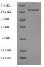 Recombinant Human Mixed lineage kinase domain-like protein (MLKL) – Figure 1 of 1