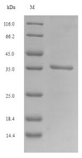 (Tris-Glycine gel) Discontinuous SDS-PAGE (reduced) with 5% enrichment gel and 15% separation gel.