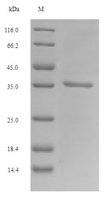 (Tris-Glycine gel) Discontinuous SDS-PAGE (reduced) with 5% enrichment gel and 15% separation gel.