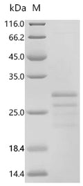 (Tris-Glycine gel) Discontinuous SDS-PAGE (reduced) with 5% enrichment gel and 15% separation gel.