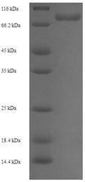 Recombinant Human Peptidyl-prolyl cis-trans isomerase-like 4 (PPIL4) – Figure 1 of 1