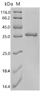 Recombinant Reston ebolavirus Pre-small/secreted glycoprotein (GP), partial – Figure 1 of 1