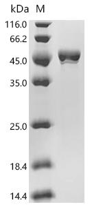 (Tris-Glycine gel) Discontinuous SDS-PAGE (reduced) with 5% enrichment gel and 15% separation gel.