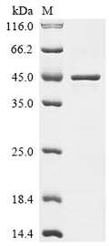 (Tris-Glycine gel) Discontinuous SDS-PAGE (reduced) with 5% enrichment gel and 15% separation gel.