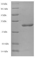 Recombinant Human Store-operated calcium entry-associated regulatory factor (SARAF), partial – Figure 1 of 1