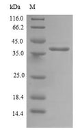 (Tris-Glycine gel) Discontinuous SDS-PAGE (reduced) with 5% enrichment gel and 15% separation gel.