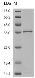 (Tris-Glycine gel) Discontinuous SDS-PAGE (reduced) with 5% enrichment gel and 15% separation gel.