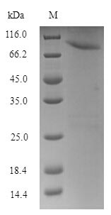Recombinant Human HSPB1-associated protein 1 (HSPBAP1) – Figure 1 of 1