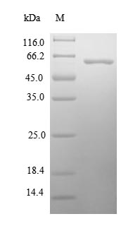Recombinant Human Paraneoplastic antigen-like protein 5 (PNMA5), partial – Figure 1 of 1