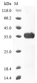 (Tris-Glycine gel) Discontinuous SDS-PAGE (reduced) with 5% enrichment gel and 15% separation gel.