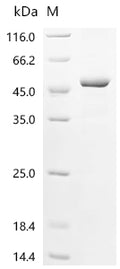 (Tris-Glycine gel) Discontinuous SDS-PAGE (reduced) with 5% enrichment gel and 15% separation gel.