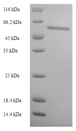 Recombinant Human FAD synthase (FLAD1) – Figure 1 of 1