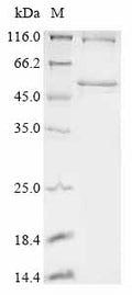 (Tris-Glycine gel) Discontinuous SDS-PAGE (reduced) with 5% enrichment gel and 15% separation gel.