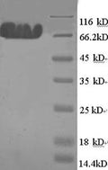 Recombinant Human E3 ubiquitin-protein ligase MYLIP (MYLIP) – Figure 1 of 1