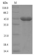 (Tris-Glycine gel) Discontinuous SDS-PAGE (reduced) with 5% enrichment gel and 15% separation gel.