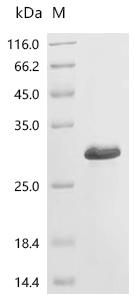 (Tris-Glycine gel) Discontinuous SDS-PAGE (reduced) with 5% enrichment gel and 15% separation gel.