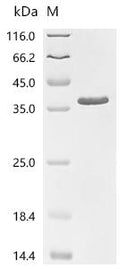 (Tris-Glycine gel) Discontinuous SDS-PAGE (reduced) with 5% enrichment gel and 15% separation gel.