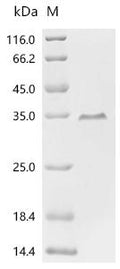 (Tris-Glycine gel) Discontinuous SDS-PAGE (reduced) with 5% enrichment gel and 15% separation gel.